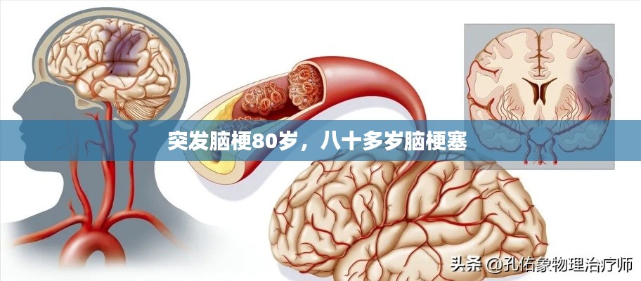 突发脑梗80岁，八十多岁脑梗塞 